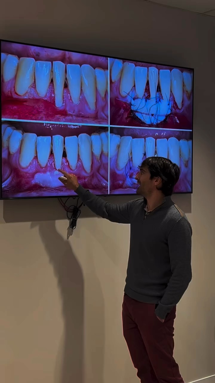 Curso de carga inmediata